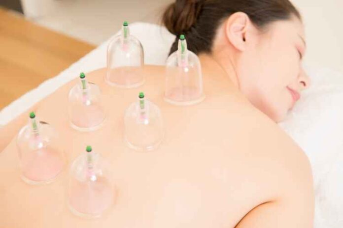 3 Areas of Focus that Cupping Helps Improve