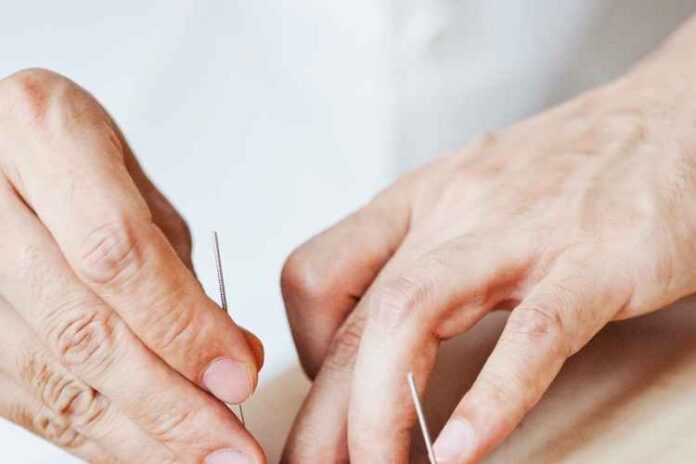 Top Ten Questions To Consider When Choosing An Acupuncture Company